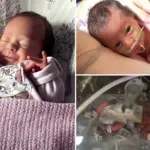 Mijn baby werd geboren met haar organen buiten haar buik – een aangrijpend verhaal uit Wiltshire