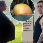 Artsen vinden tumor van 27 kilo in buik van man die jarenlang werd weggezet als ’te zwaar’