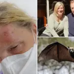 Australische toerist in Cairns gebeten door vleermuis: vrees voor dodelijk virus