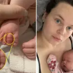 Een haarstrengetje zorgde bijna voor amputatie bij baby — Britse moeder waarschuwt voor onbekend gevaar