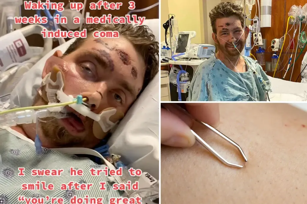 Man uit Texas overleeft coma met slechts 4% kans – door een ingegroeide schaamhaar