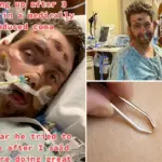Man uit Texas overleeft coma met slechts 4% kans – door een ingegroeide schaamhaar