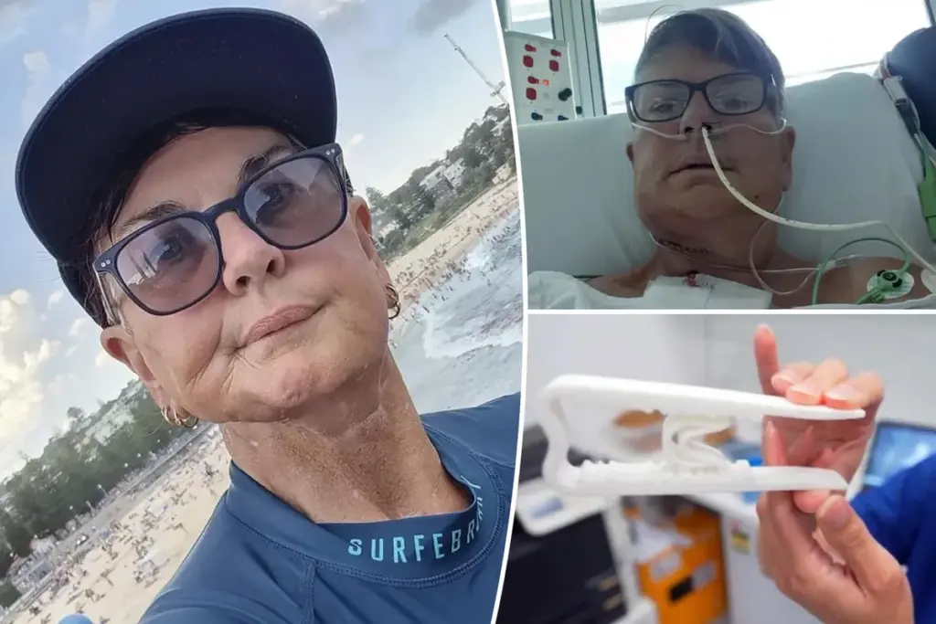 Australische vrouw spreekt plotseling met Brits accent na kaakoperatie
