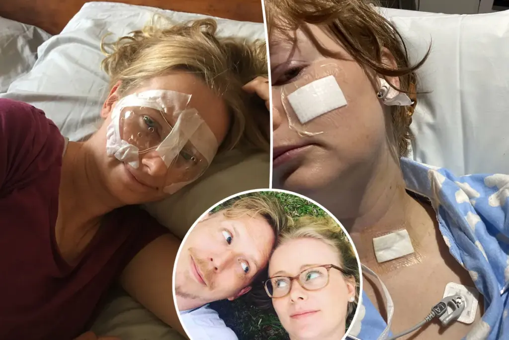 Ik liet LASIK doen voor mijn bruiloft — nu leef ik dagelijks met pijn