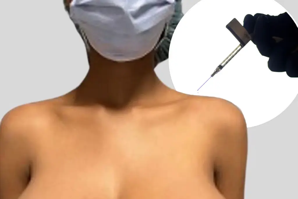 Borstgroei tot cup G bij tiener na COVID-vaccinatie: hoe zeldzaam is dit?