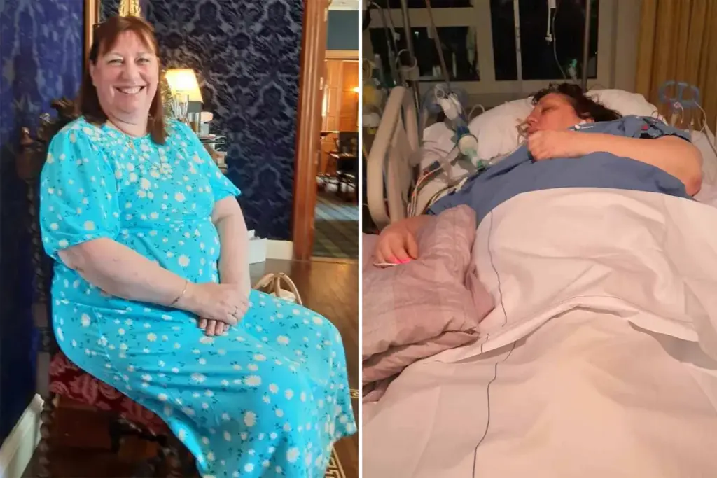 Vrouw dacht dat ze griep had – tot een vleesetende infectie haar leven redde