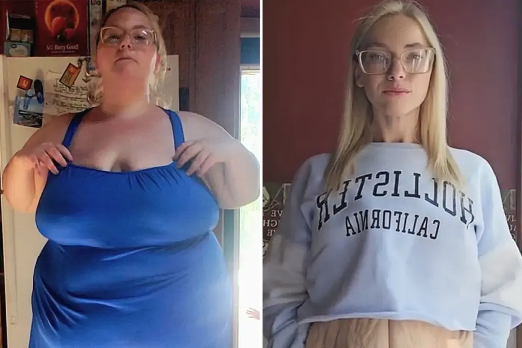 Ik verloor 83 kilo — trolls drijven de spot met mijn overtollige huid